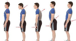 مركز فحص تشوهات العمود الفقري عند الأطفال