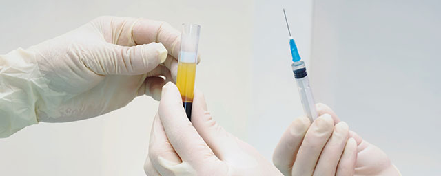 ACP i PRP terapija ACP i PRP terapija