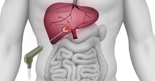 MicroWave - mikrotalasi