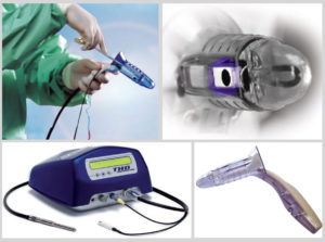 Operacija hemoroida - THD metoda