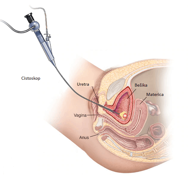 Cystoscopy 