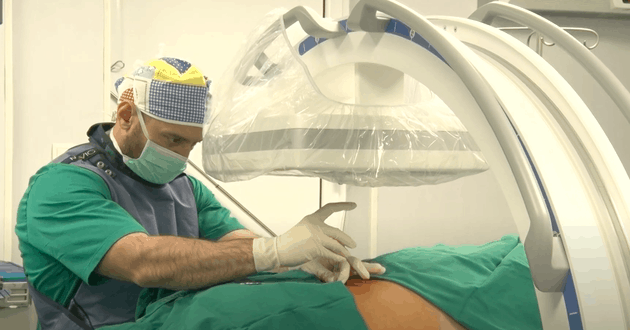 Dekompresija spinalnog nerva