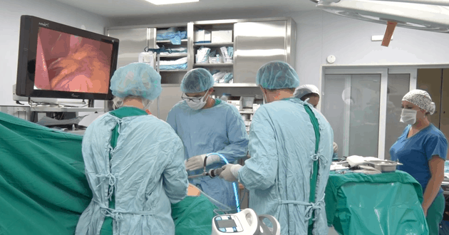 laparoskopska sleeve gastrektomija